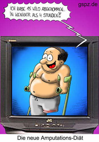 amputation