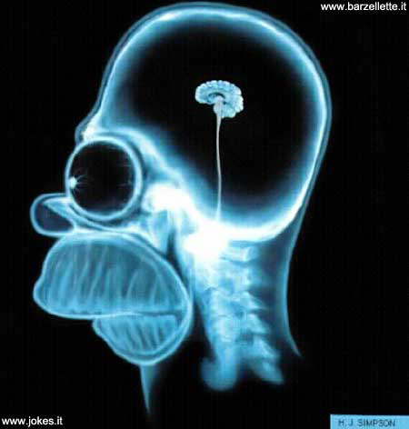 homerbrain